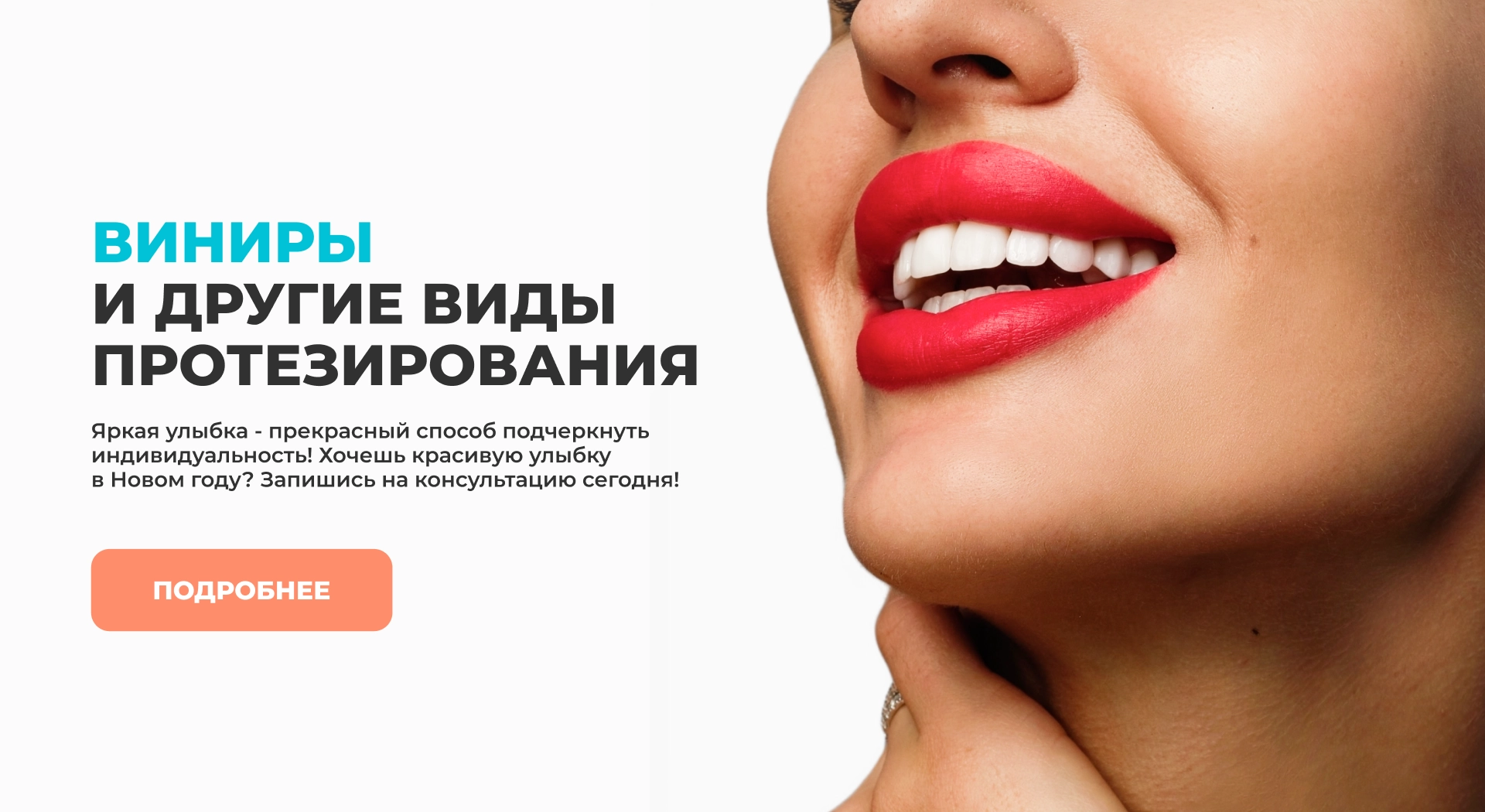 Виниры