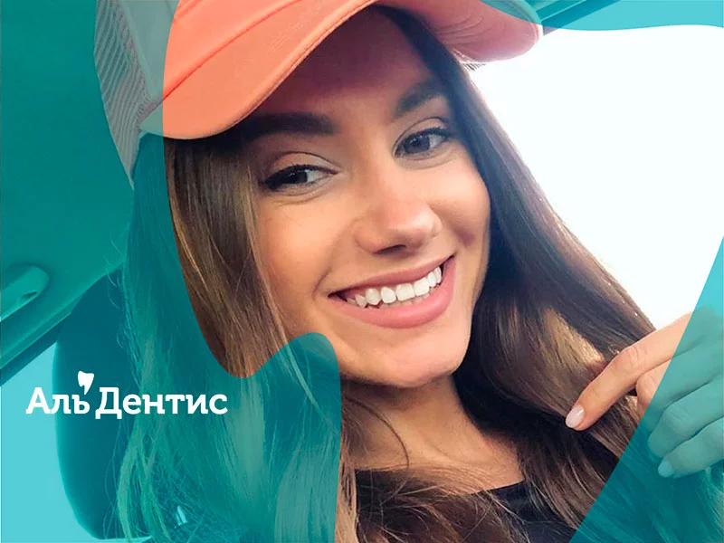 Уход за улыбкой. Лечение.