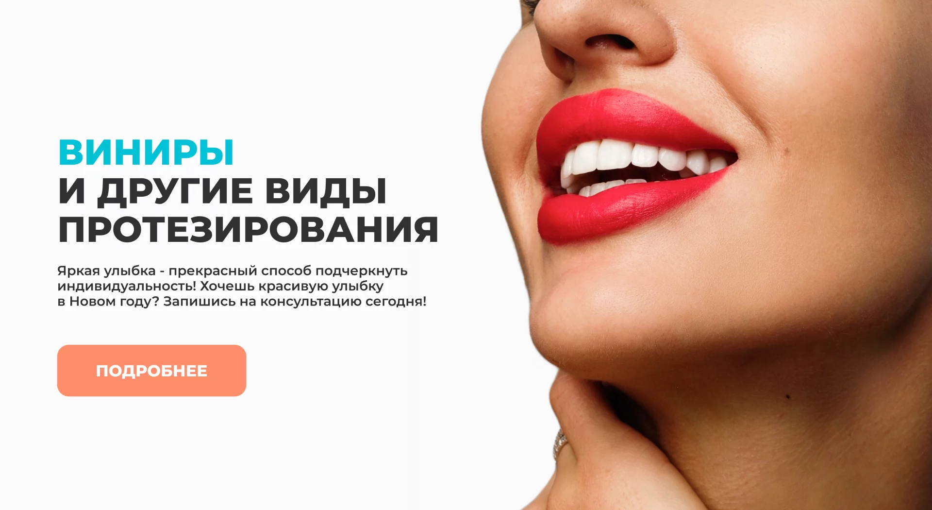 Виниры